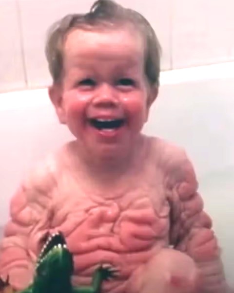 Niemowlak z twarzą staruszka